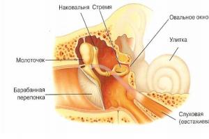 Symptoms of catarrhal otitis and description of the disease