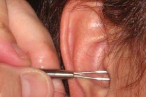 Kaip gydyti ausų grybelį?